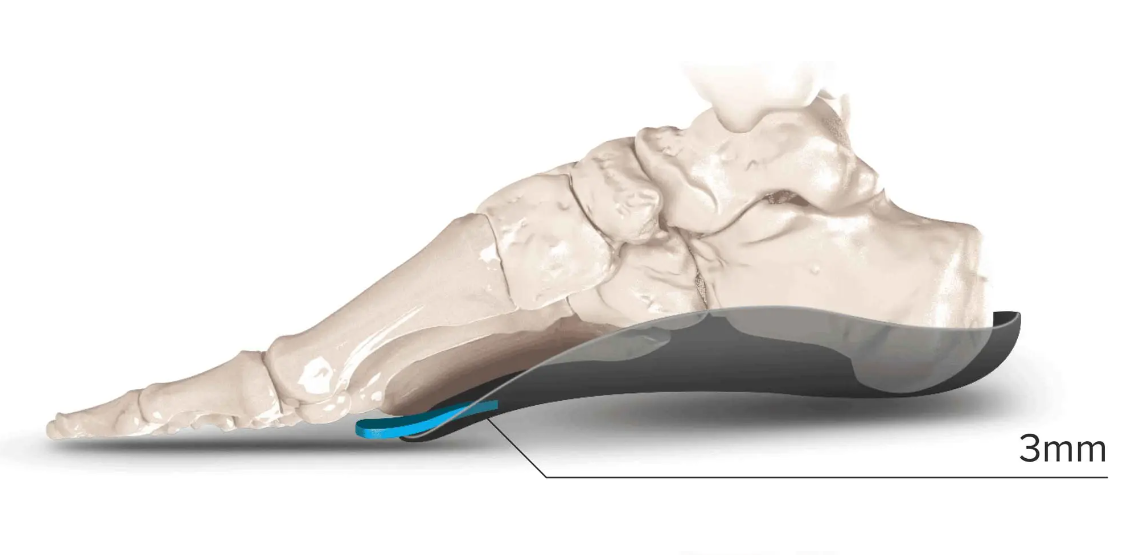 Metatarsal Pad